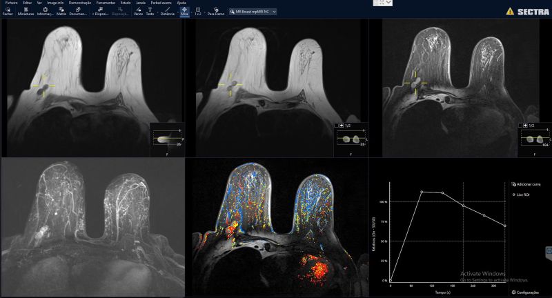 Mp Mri Sectra Global E Learning - Artistic Retina Colorful Backgrounds | Free Download